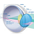 Što je to astigmatizam?
